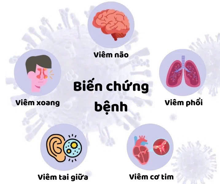 Bệnh cúm A và những biến chứng cần được cảnh giác