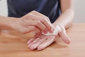 Lòng bàn tay đổ mồ hôi (Palmar Hyperhidrosis)