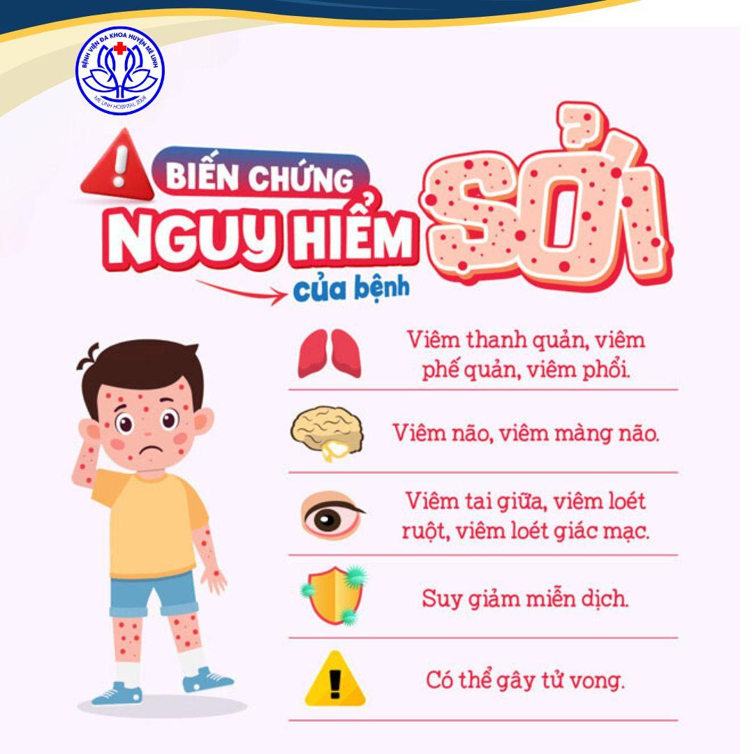 NÂNG CAO CÁC BIỆN PHÁP PHÒNG BỆNH SỞI